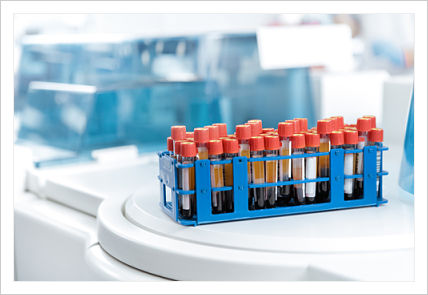 A photo of a small blue container full of blood sample vials sitting on a white table